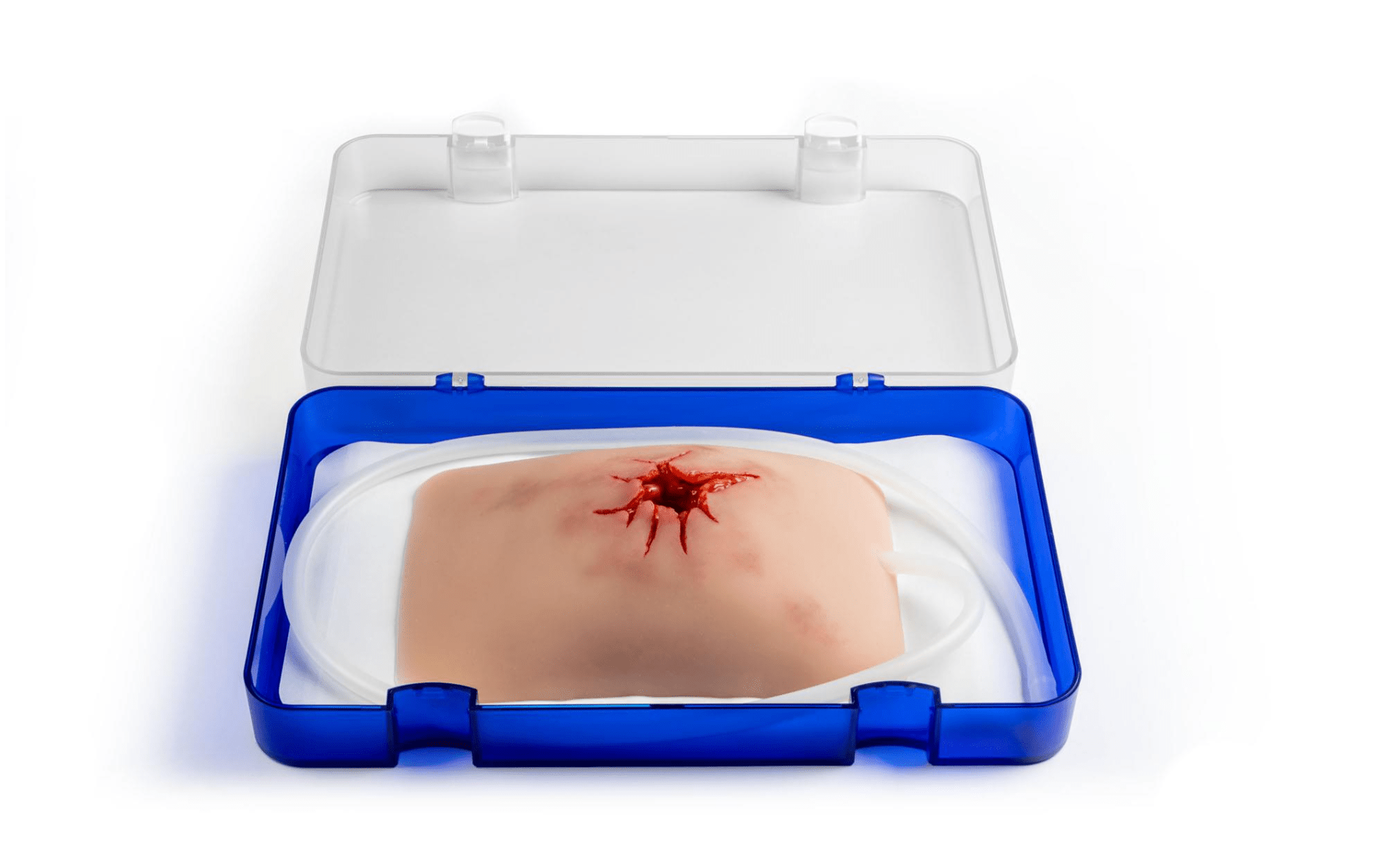 Wundmoulage Schuß Leiste, Wound Packing - Erler - Zimmer